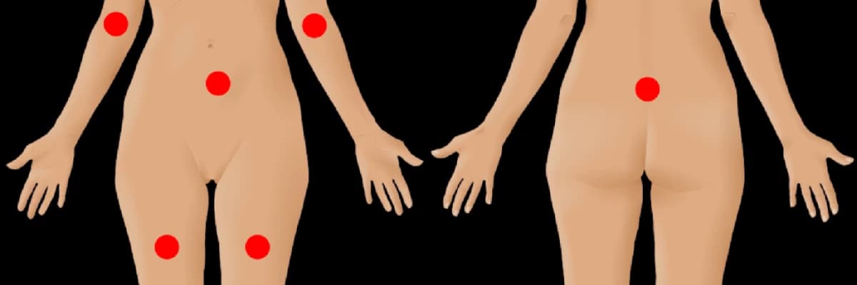 Fibromiyalgiya