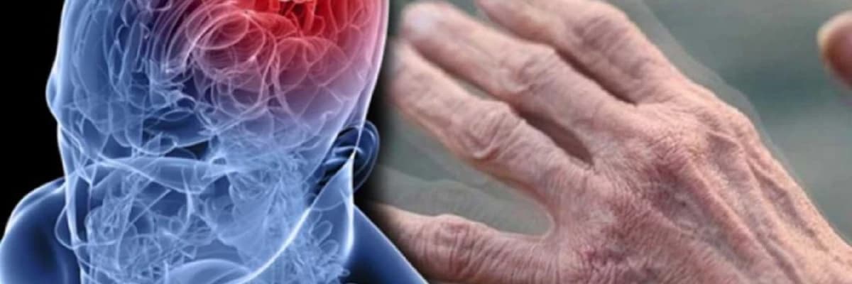 Parkinson Xəstəliyi: Səbəblər, Tanı, və Həyat Üçün İdarə Yolları