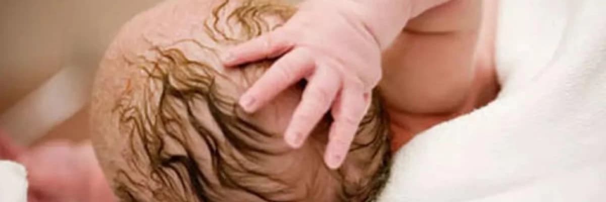 Yeni doğulmuş uşaqlarda ümumi doğuş travmaları