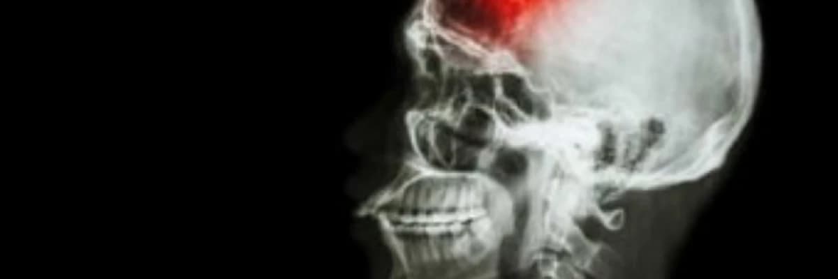 Kəllə Formasının Pozulması: Səbəbləri, Növləri və Müalicə Yolları