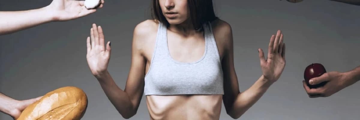 Anoreksiya