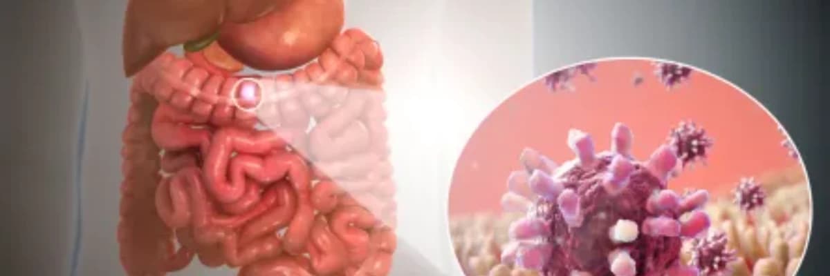Enterit xesteliyi