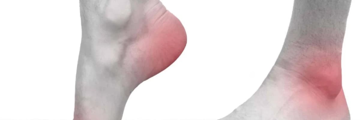 Nevropatik ağrılar