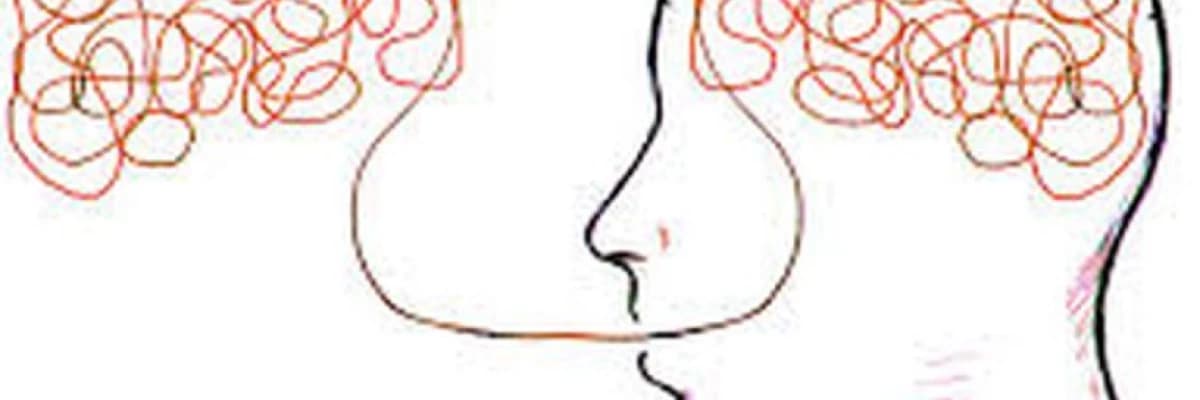 “Xarici aksent” sindromu