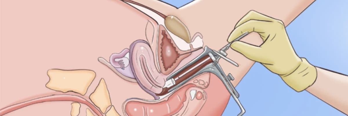 Smear, serviko-vaginal mədəniyyət