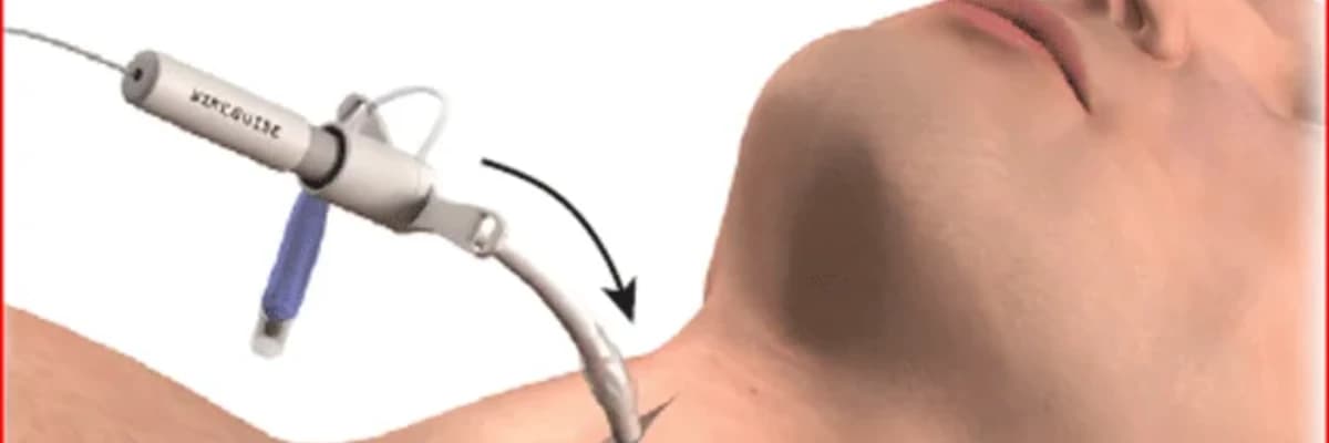 Trakeal şişkinliklərin mənası, səbəbləri, simptomları və müalicə üsulları: Traxeyada anormal böyümələrə baxış