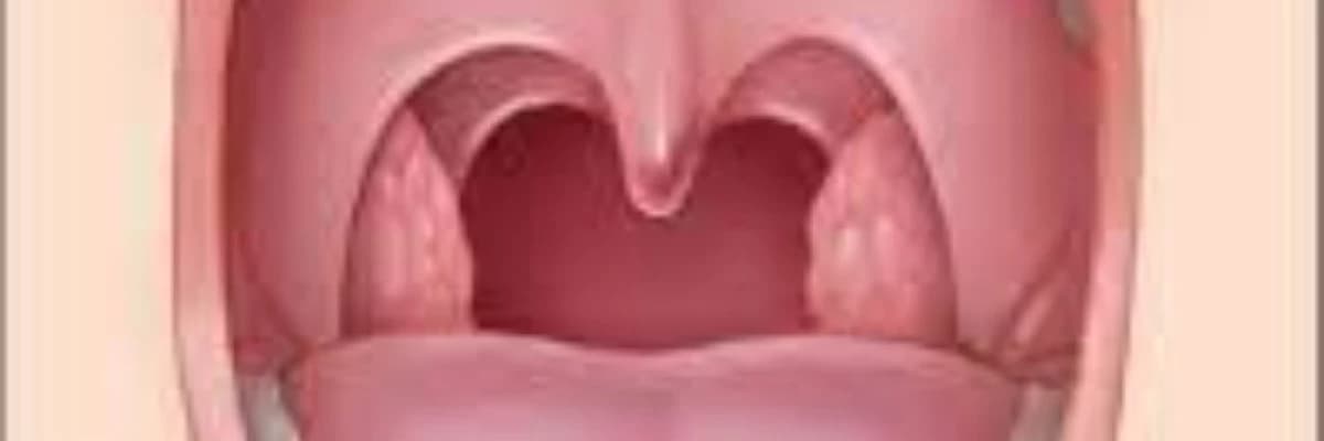 Kəskin və xroniki tonzillit