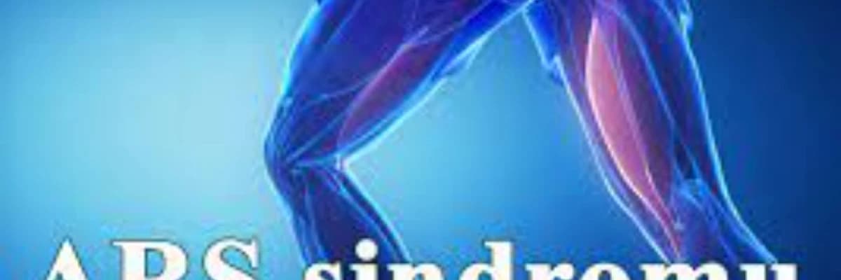 Ars sindromu