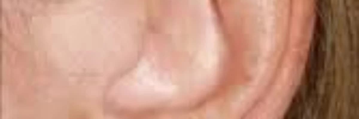 Aurikülün olmaması, çıxıntılı qulaq və digər deformasiyalar