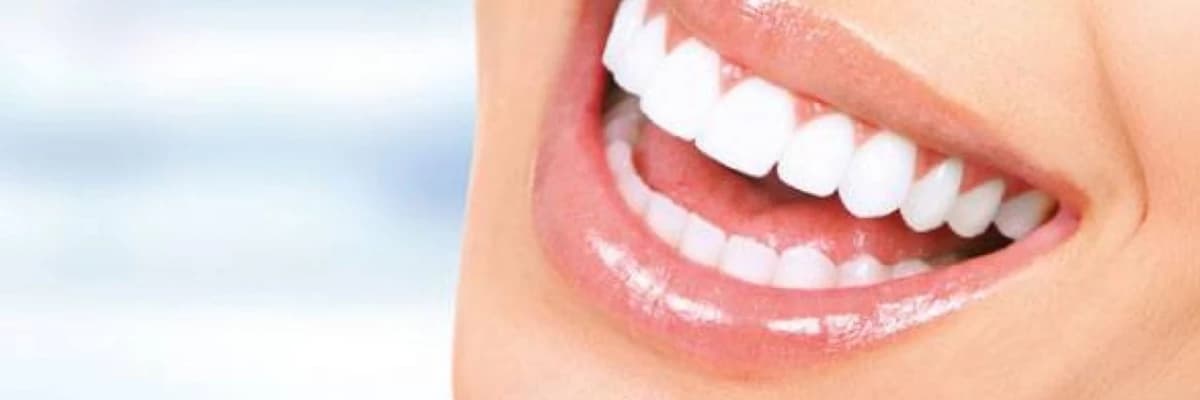 Estetik və davamlı: keramika dişləri haqqında nə bilmək lazımdır