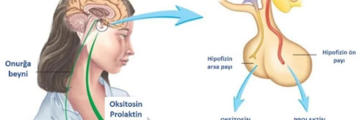 Prolaktin (süd hormonu) hormon yüksəkliyi (PROLAKTİNOMA)