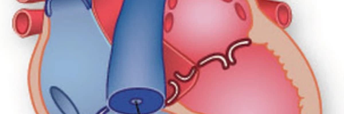 Pulmonal qapaq darlığı