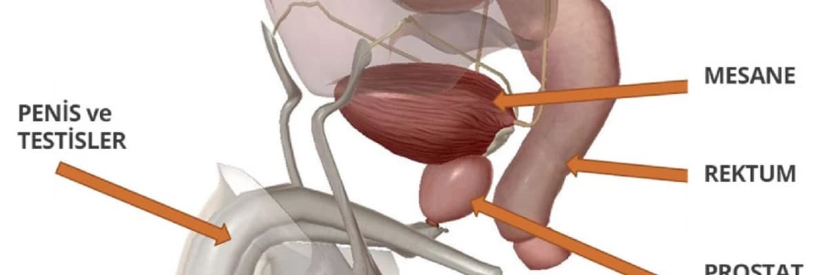 Prostat Xərçəngi: Kişilərdə Ümumi Sağlamlıq Problemi