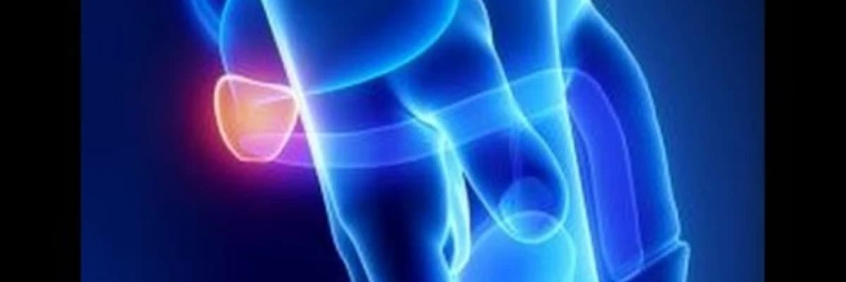 İmpotensiya xesteliyi haqqında