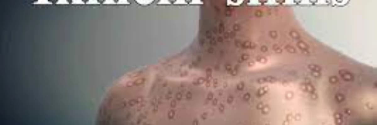 İkincili sifilis hakkında