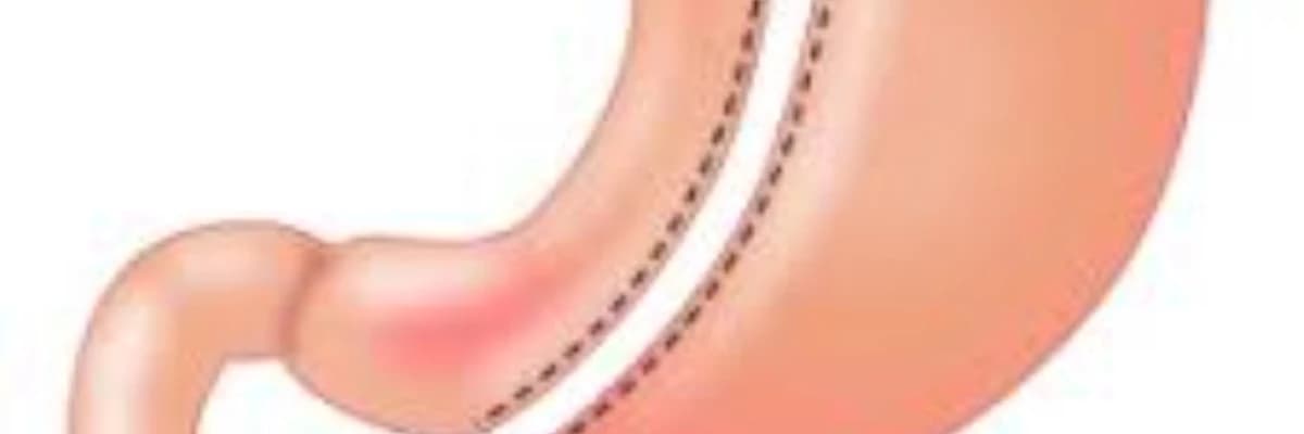 Abdominal əməliyyatların aparılması
