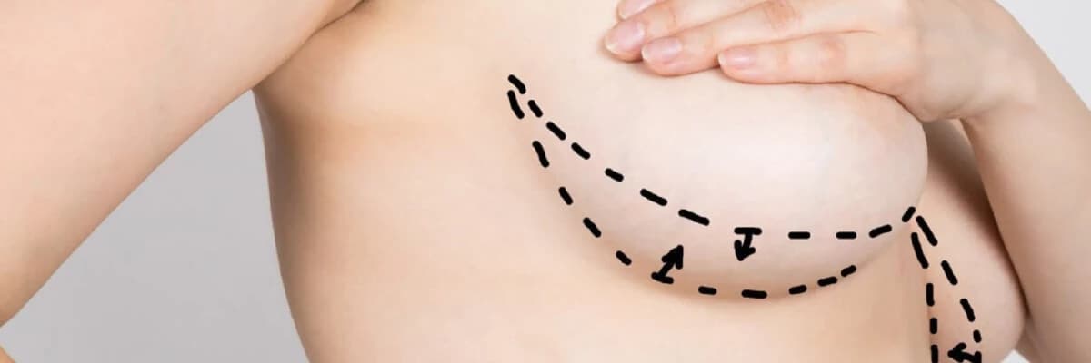 Döş Kiçiltmə Estetikasının Sosial Həyata Təsirləri