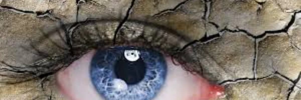 QURU GÖZ XƏSTƏLİYİ