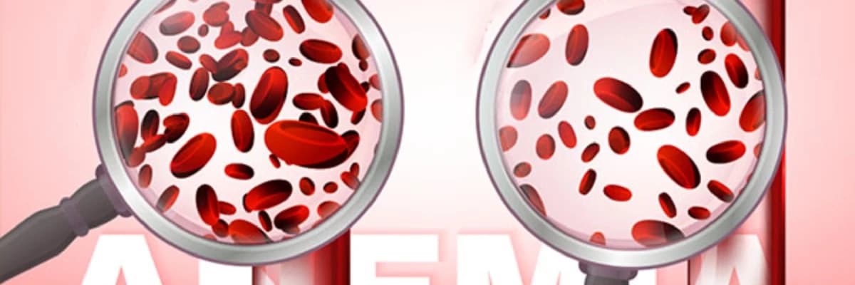 Anemiya, sümük iliyi çatışmazlığı