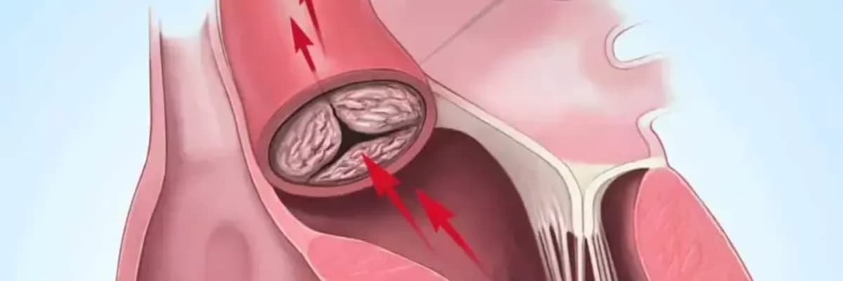 Aortal patologiyalar haqqında