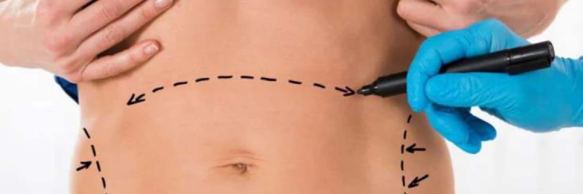 Bədən şəkilləndirmə