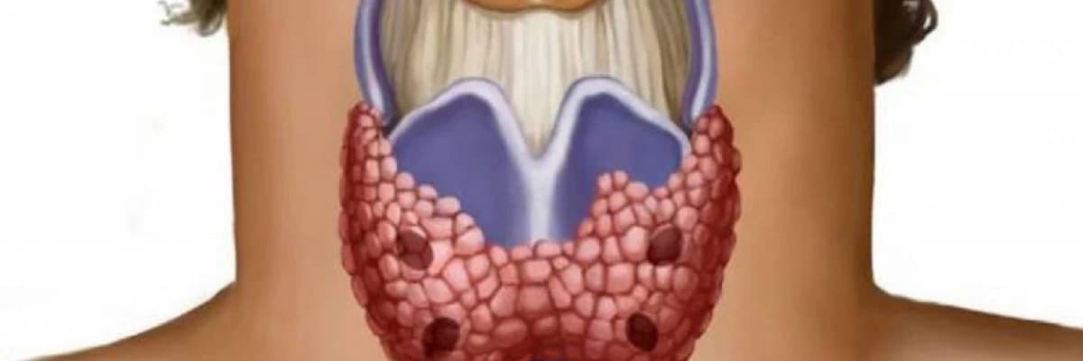 ZOB XƏSTƏLİYİ / ZOB XƏSTƏLİYİNİN ƏLAMƏTLƏRİ / DÜYÜNLÜ UR / QALXANVARİ VƏZİ XƏSTƏLİKLƏRİ