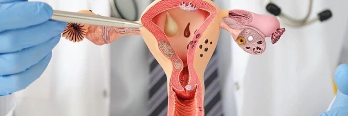 Endometrit