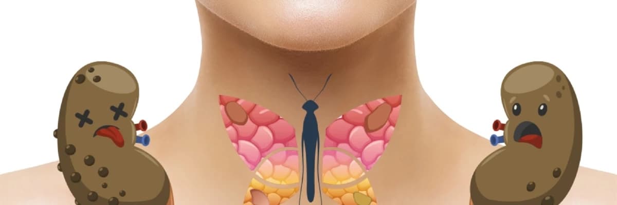 Hiperparatireoz: simptomları, səbəbləri və müalicəsi
