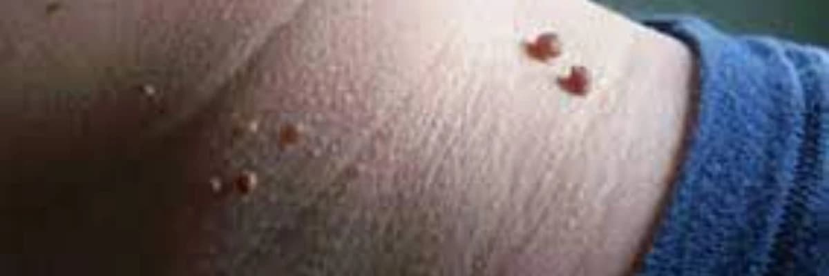 Xallar və törəmələr