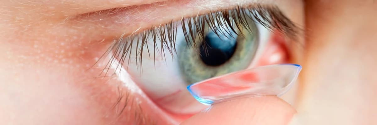 Keratokonuslarda sərt ve yumşaq kontakt linzalar ilə korreksiya