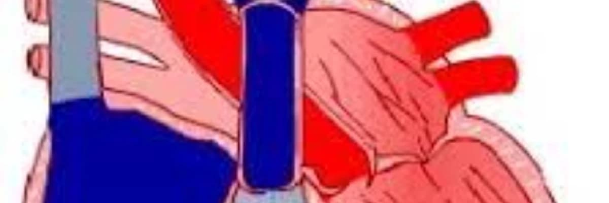 Aciq arterial axacaq