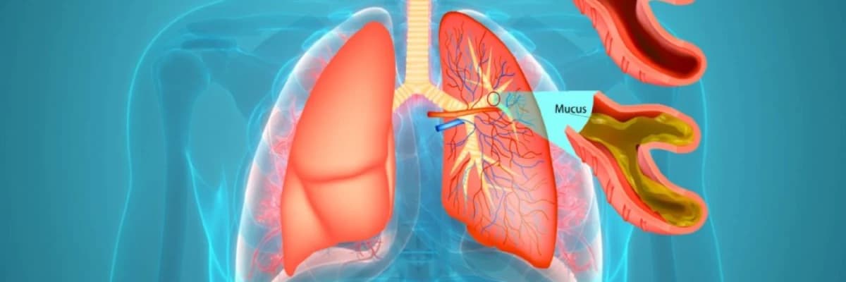 Bronxit: Tənəffüs sisteminin iltihabı