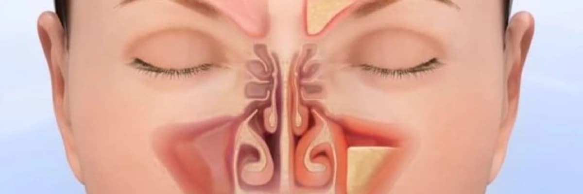 Rinologiya: Burun və Sinus Sağlamlığı Elmı