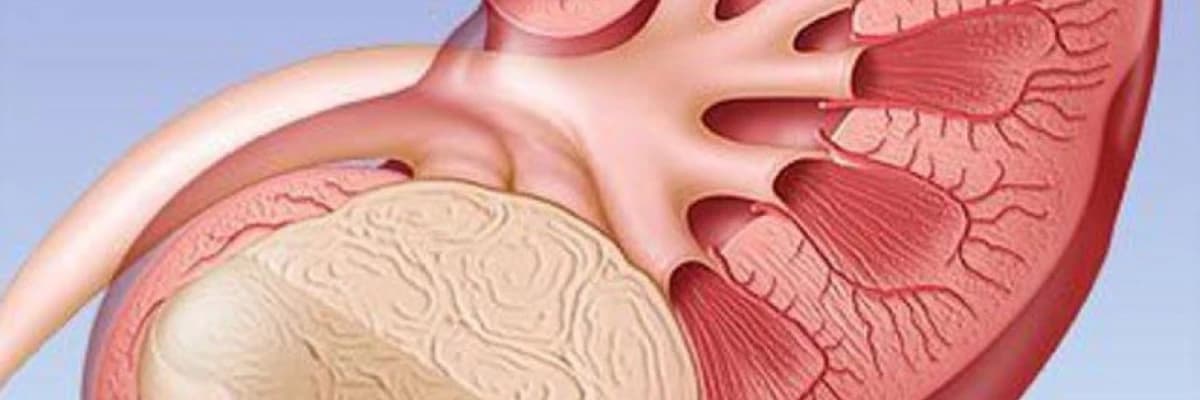 Böyrək şişinin müalicəsi necə olmalıdır?