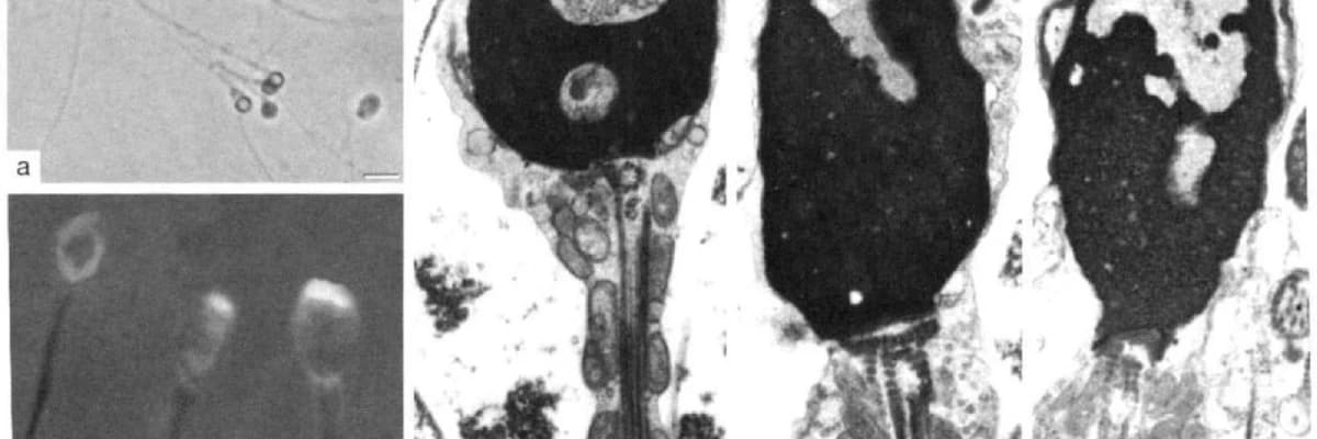 Spermada irin (piospermiya)