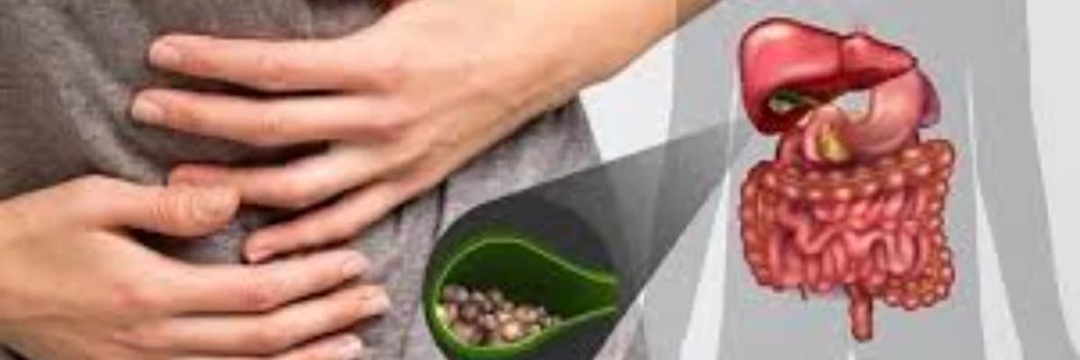 Öd kisəsi diskineziyası
