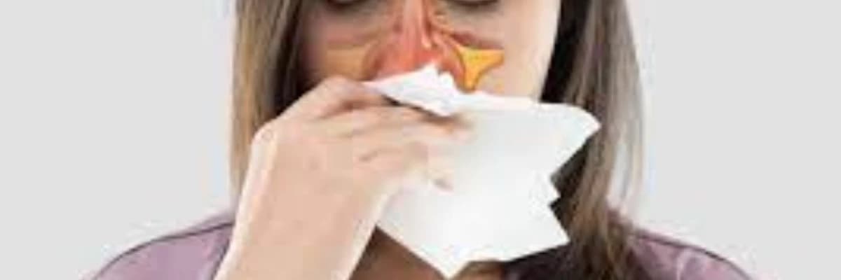 Sinüzit, allergik xəstəliklər