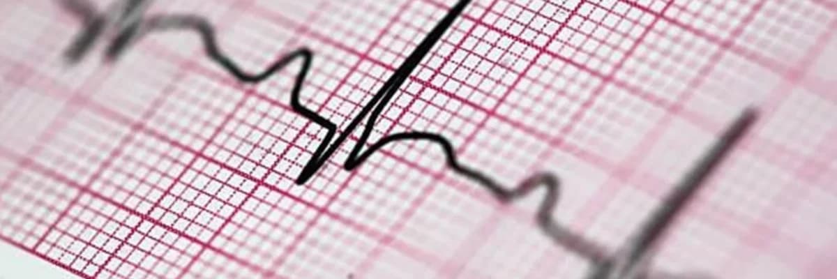 Elektrokardioqrafiya (EKQ): Ürəyin elektrik fəaliyyətinin tədqiqi