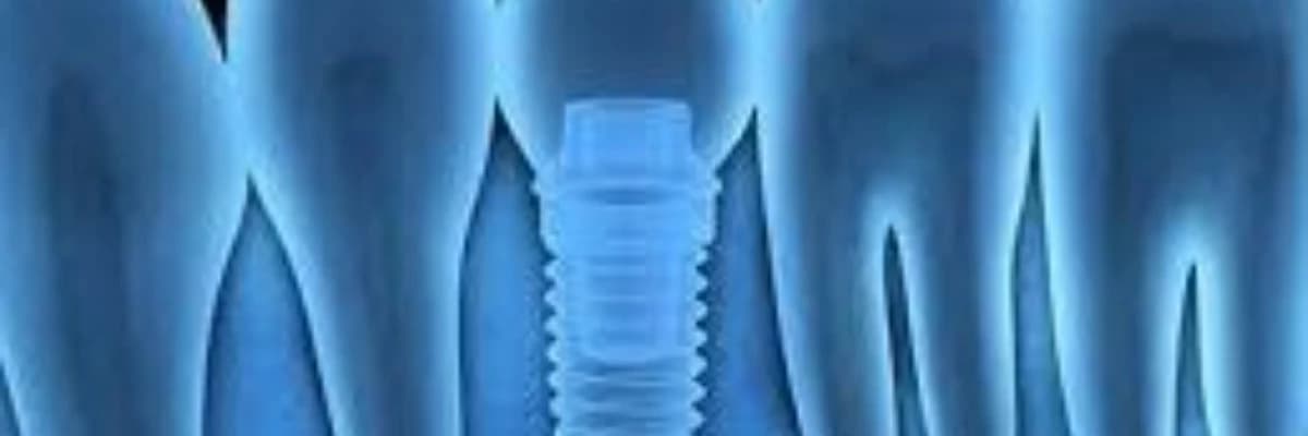 Rentgen diaqnostikası