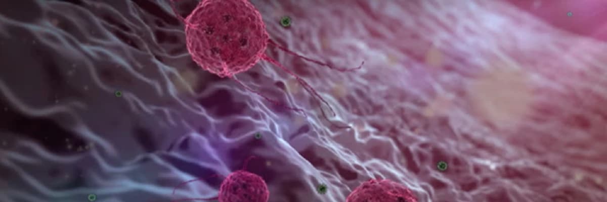 Anogenital kondilomatoz