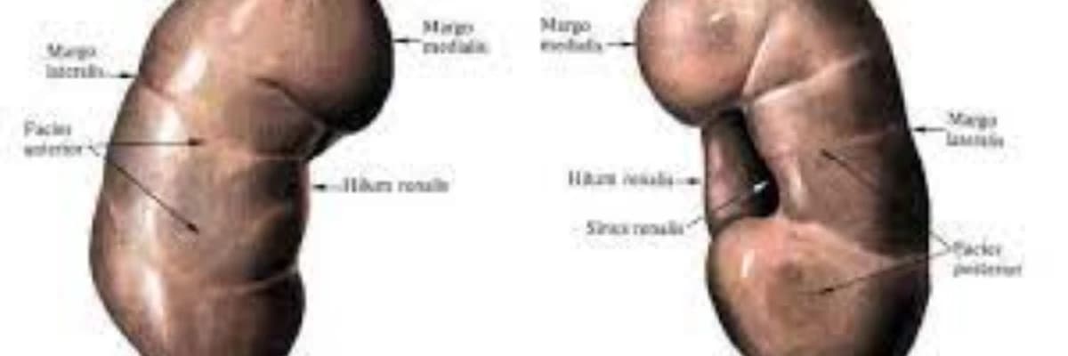 apostematoz pielonefrit