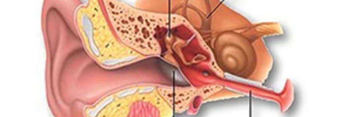 Qulaq pərdəsinin təmiri proseduru: