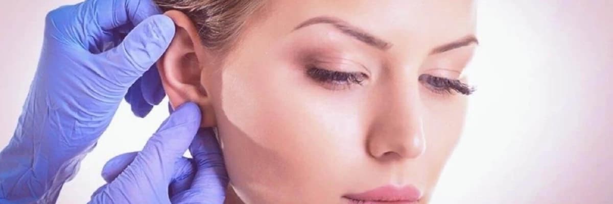 Otoplastika haqqında