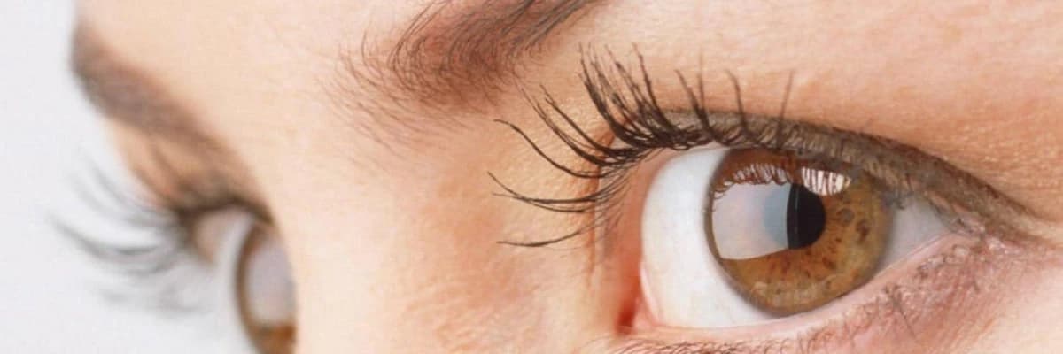 Refraksiya xətaları