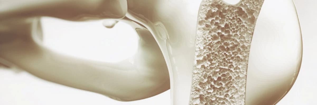 Osteoporoz