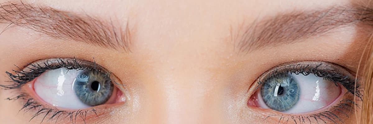 Çəpgözlük (gözlərin düzgün düzülməməsi və ya sapması)