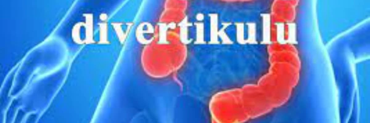 Duz bagirsagin divertikulu