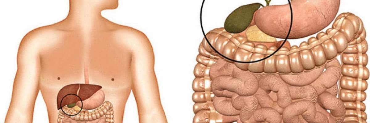Qaraciyər, mədə və öd kisəsi kimi həzm sistemi xəstəlikləri