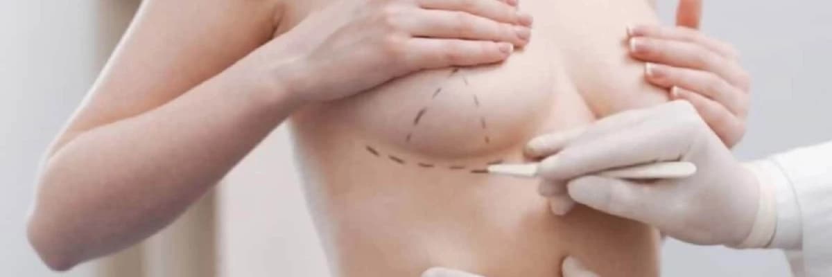 Süd vəz plastikası (mamoplastika)