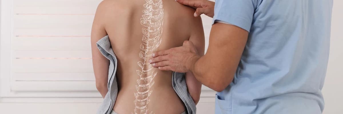 SKOLİOZ. Müalicə və Reabiliyasiyası.